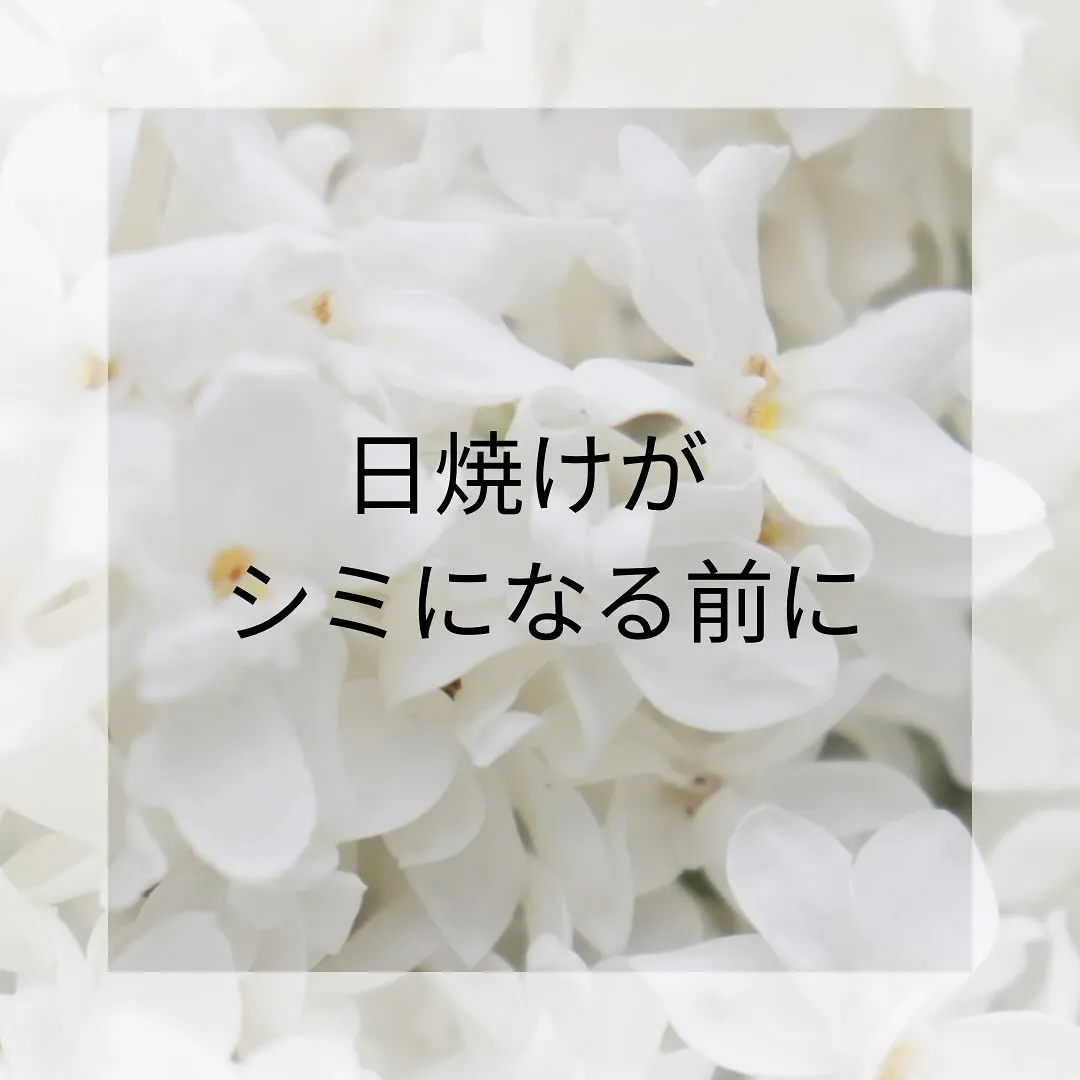 夏のレジャーに日焼け止めは必須！